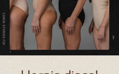 Hernia discal